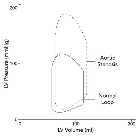 pressure volume loop aortic stenosis.